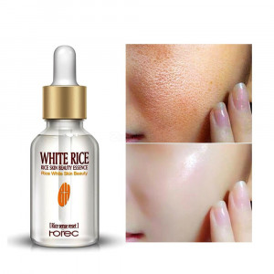 Rorec White Rice Skin Beauty Essence Face Serum